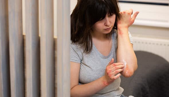 Heat Treatment for Bed Bugs Auburn Hills