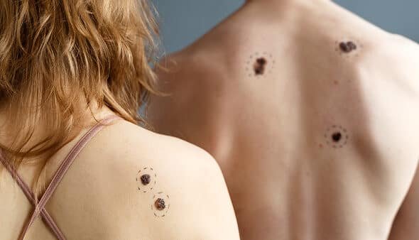 Heat Treatment for Bed Bugs in Rochester Hills, MI