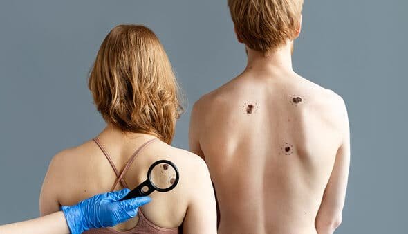 Heat Treatment for Bed Bugs in Rochester Hills, MI